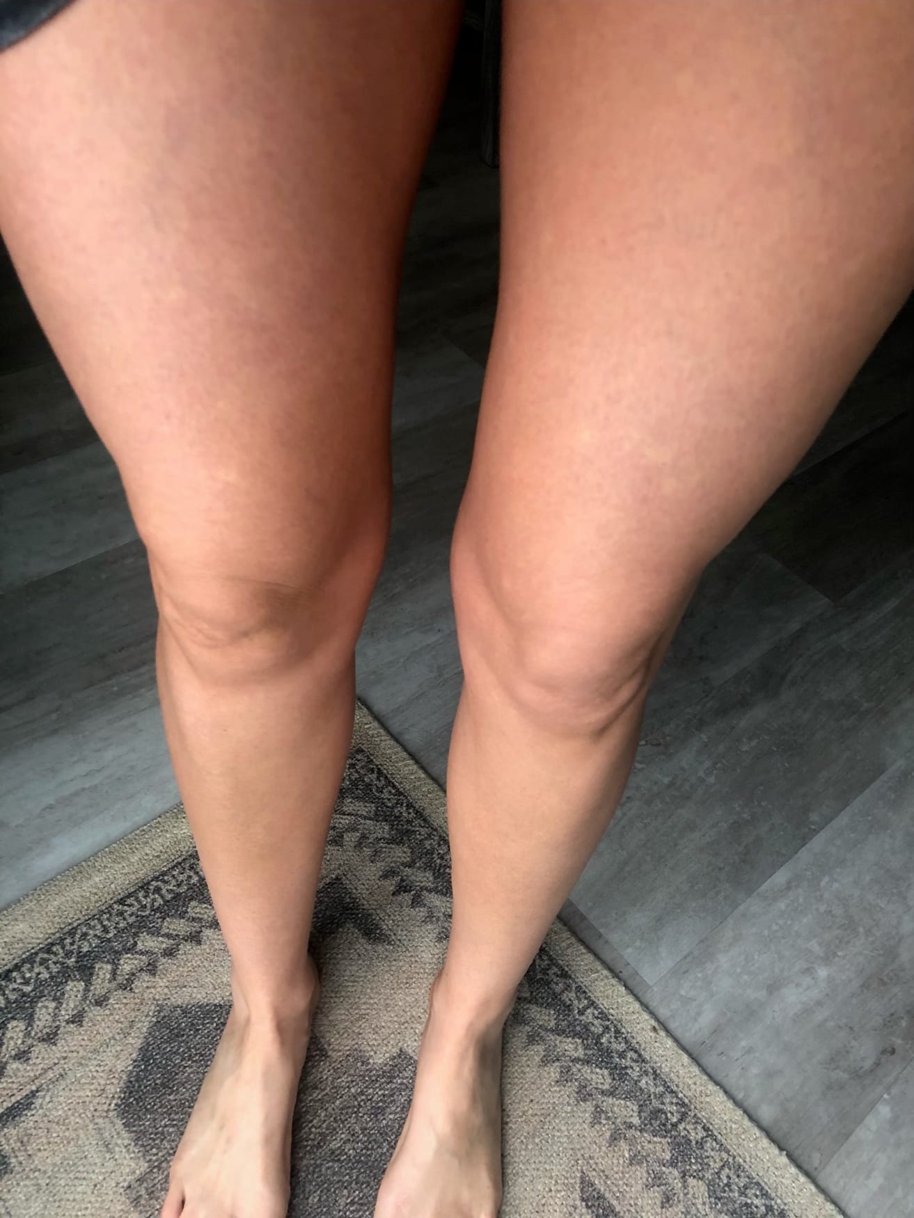 Flawless, natural-looking spray tan on legs