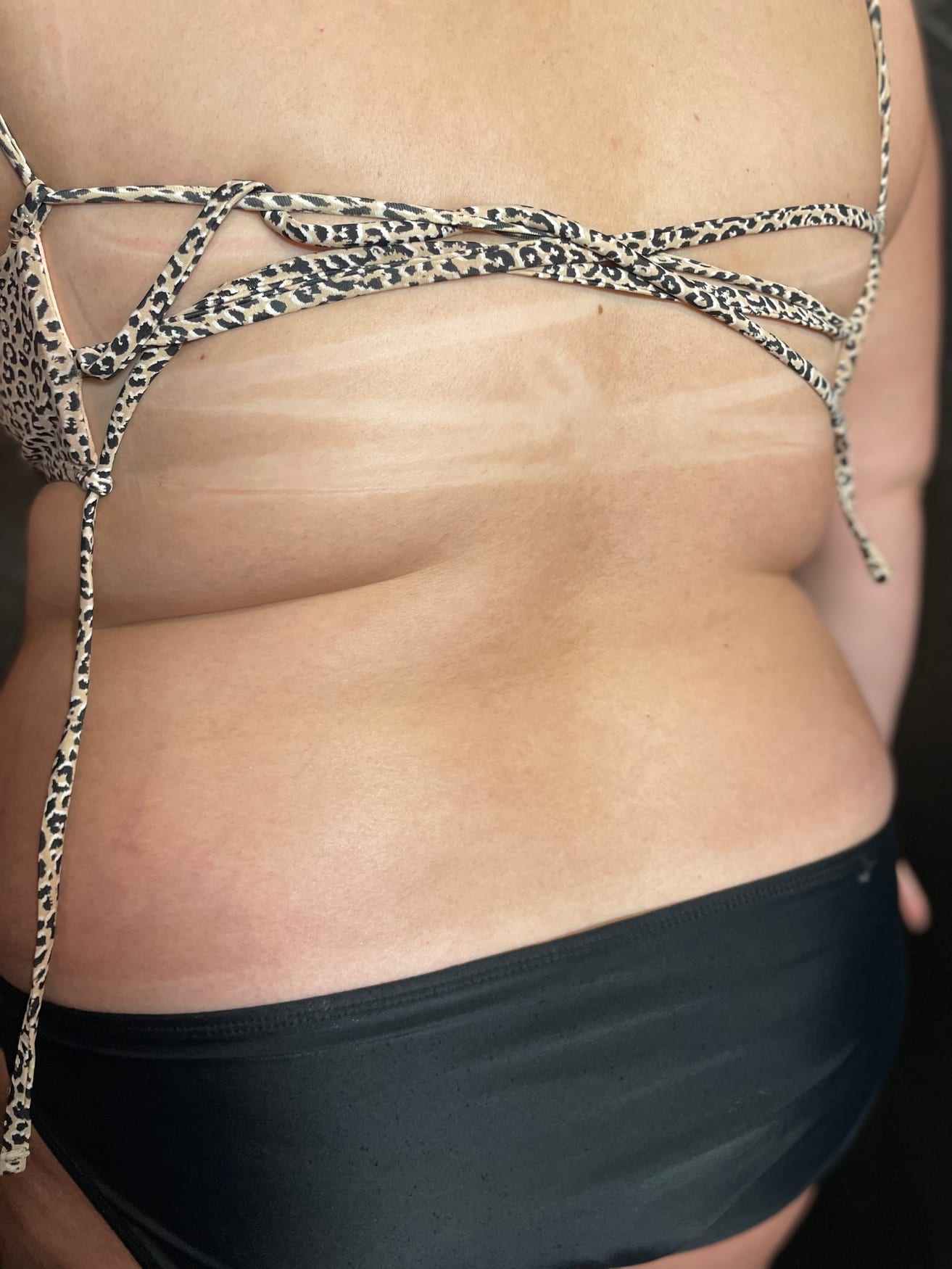 Even, streak-free bronze spray tan across the back